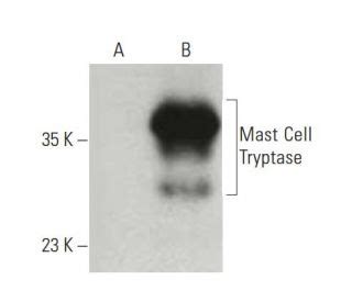 Mast Cell Tryptase Antibody (G3)Korey - Western Blotting - Image 396532