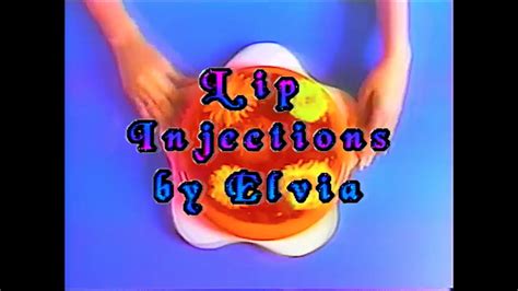 LIP INJECTIONS SHOT BY SHANNON G. - YouTube