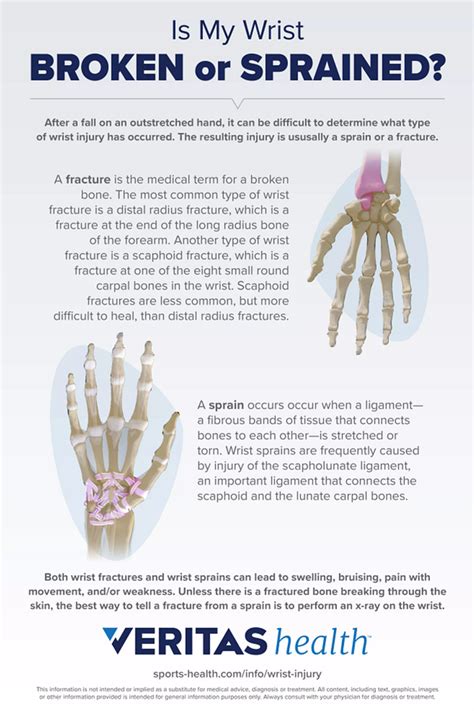 Wrist Sprain Exercises