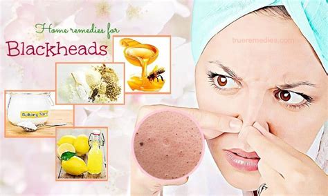 34 Home Remedies For Blackheads On Nose & Face Removal