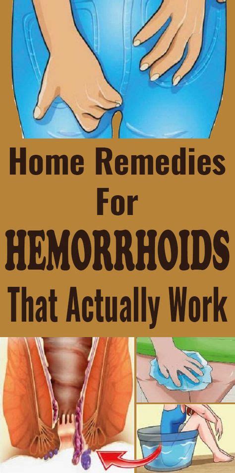 Home Remedies for Hemorrhoids | Home remedies for hemorrhoids, Getting ...