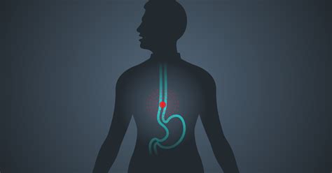 Lower Esophageal Sphincter and Its Anatomy: A Guideline