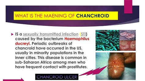 CHANCROID PRESENTATION FROM STUDENT @ CHNTS ESIAMA- C15B GROUP