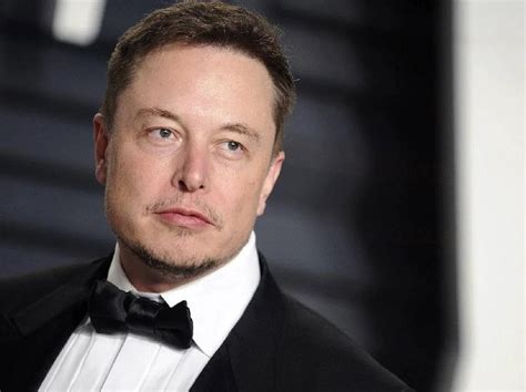 Elon Musk Hair Transplant - Wonder Hair Clinic