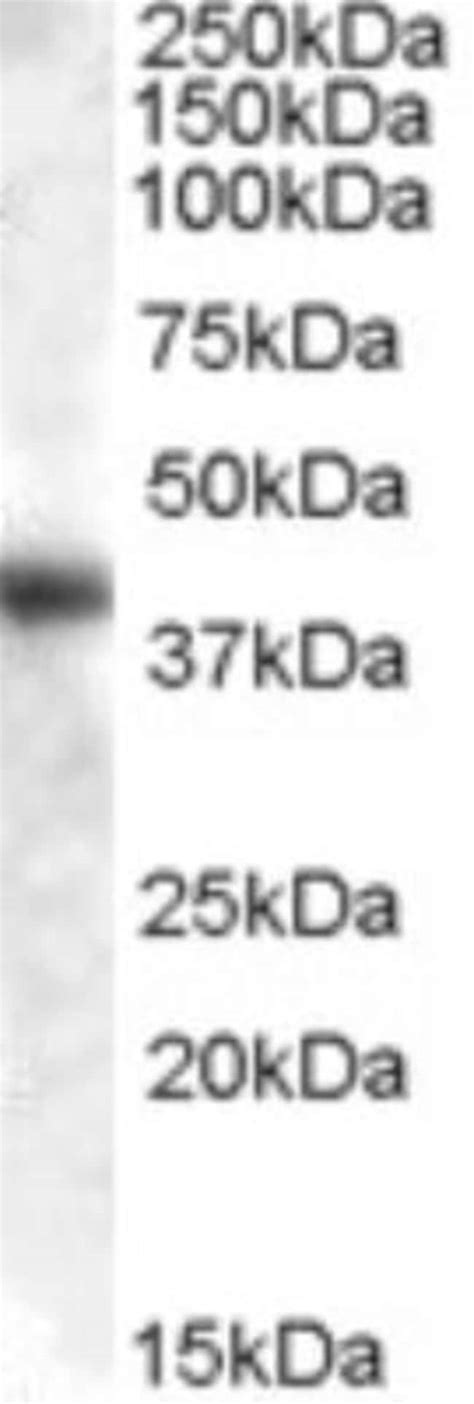 Aspartate Aminotransferase Antibody 0.1mg; Unlabeled:Antibodies, Polyclonal | Fisher Scientific