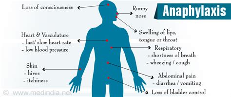 Anaphylaxis Rash / Anaphylaxis | Grace ER | 24 Hr. Urgent Care and much more - Other organ ...