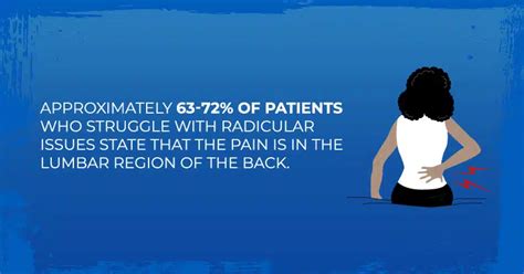 Radicular Pain | Signs And Symptoms | Treatment | J.Flowers