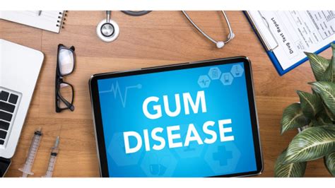 Gum Disease Home Remedies to Prevent & Reverse Early Gingivitis: Guide Released