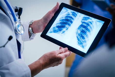 New First-Line Treatment Option for NSCLC: Nivolumab + Ipilimumab ...