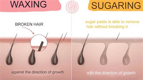 Sugaring vs Waxing: Which Hair Removal Method Lasts Longer