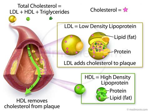 The Fatty Plaque In Your Arteries: Can It Be Melted Away? – 215 ...