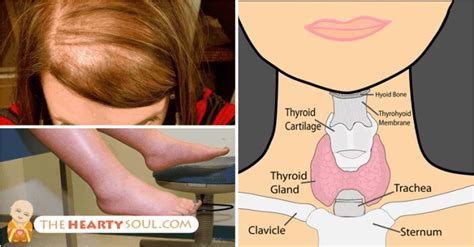 Complete List of Hypothyroidism Symptoms with Checklist and Lab Guide