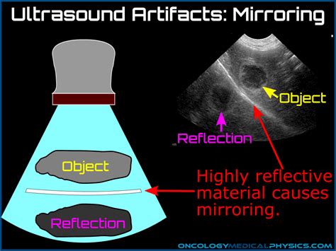 Ultrasound | Oncology Medical Physics