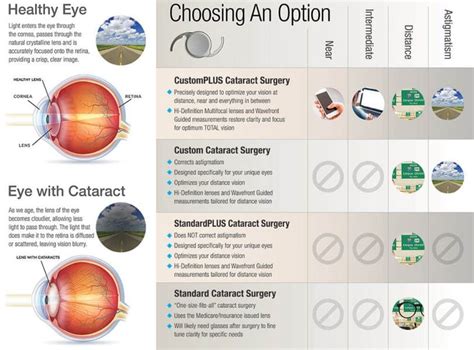 Cataracts surgery lens options | doctorvisit