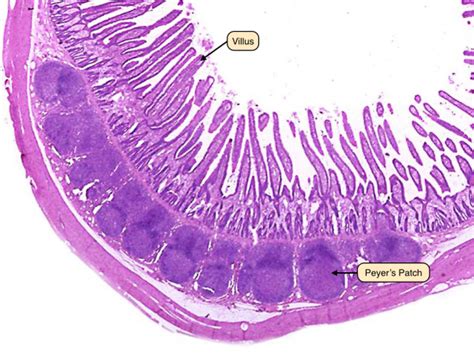 Peyer Patches, Tiny Tonsils In Your Small Intestine Are Part Of The ...