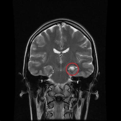 Viewing playlist: AA-JUNEPIN | Radiopaedia.org | Neurology, Radiology ...