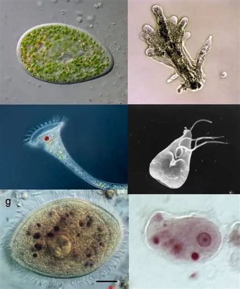 Protozoa: Explained – Microscope Clarity