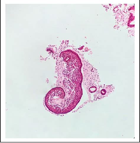 Figure 1 from Sesquicentennial Evidence for Ernst Haeckel’s “Ontogeny ...