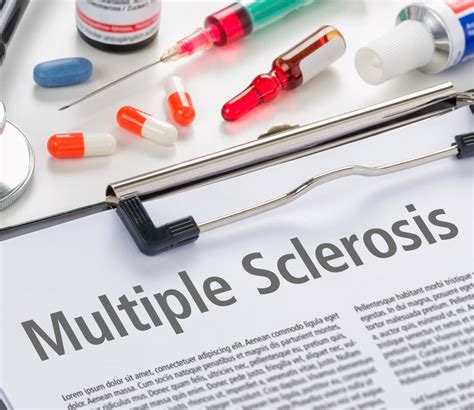 Neurology News: Early Treatment for Multiple Sclerosis May Lower Risk of Developing Secondary ...