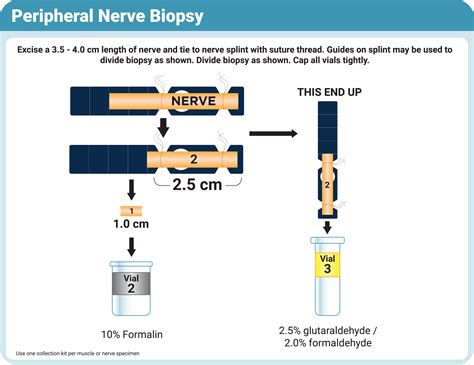 Nerve Biopsy - Therapath Neuropathology