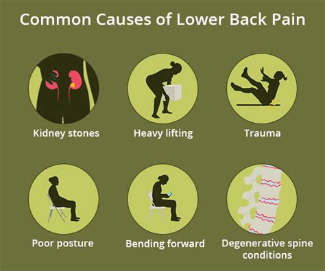 Low Back Pain Doctors NJ & NYC | Back Pain & Injury Treatments