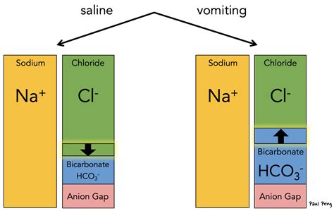 Anion Gap Metabolic Acidosis - Causes of Non-Anion Gap Metabolic ...