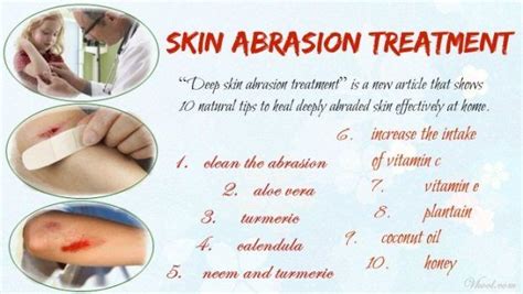 10 Natural Tips Of Deep Skin Abrasion Treatment