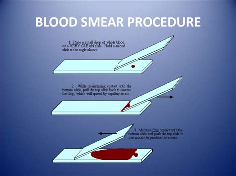 Blood smear