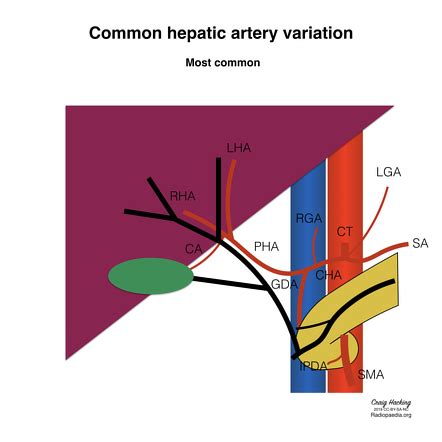 Hepatic Artery