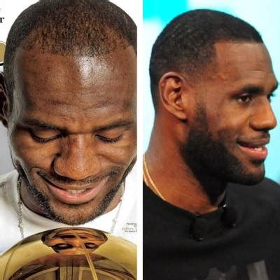 LeBron James Hair Transplant Proof – Before and After | FAMEWATCHER