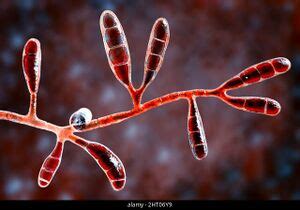 Epidermophyton floccosum - microbewiki