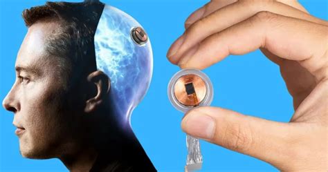 Elon Musk’s Neuralink Brain Implant Approved For Human Trails - Glancy News