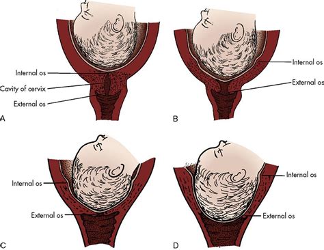 6. Process of Normal Labor | Nurse Key