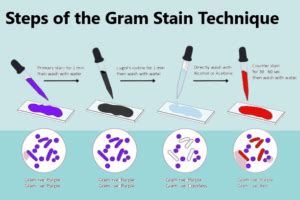 Principle Of Gram Staining 2023 » Flair Pharma The Knowledge Kit.