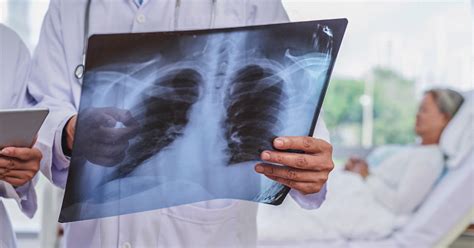 Miliary TB: Differential Diagnosis, Vs. Pulmonary Tuberculosis, More