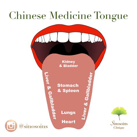 Chinese Medicine Tongue Map | Clinic Sinosoins