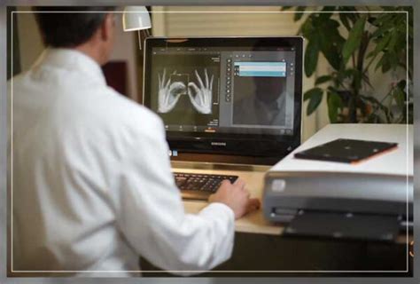 Computed Radiography: Advantages, Equipment and More - Engiomed