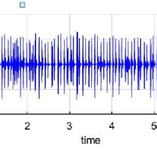 (PDF) Recurrent Neural Network Based Classification of ECG Signal ...