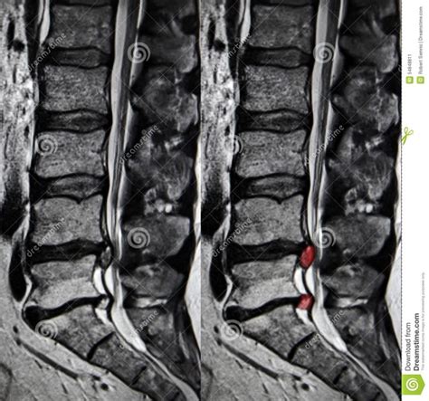 Pin on Mri Scans