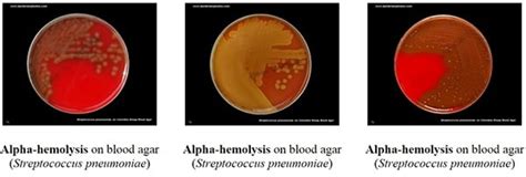 Blood Agar- Composition, Preparation, Uses and Pictures