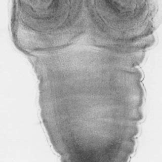 Taenia saginata adult scolex, showing suckers. Source: From Ref. 32. | Download Scientific Diagram