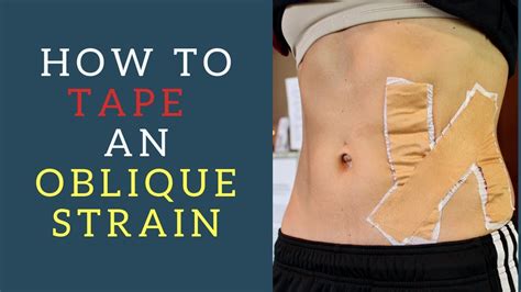 Oblique Strain Taping - YouTube