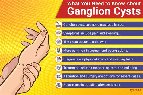 Ganglion Cyst: Symptoms, Causes, Risk-factors, Diagnosis and Treatment ...