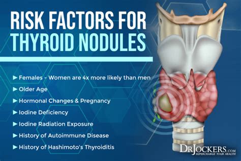 Thyroid Nodules: Symptoms, Causes, and Support Strategies