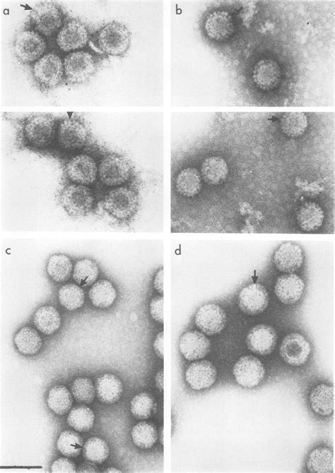 Capsomer structure of reovirus type 1 (a, b), or reovirus type 3 (c ...