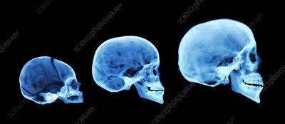 Human skull development - Stock Image - P120/0208 - Science Photo Library