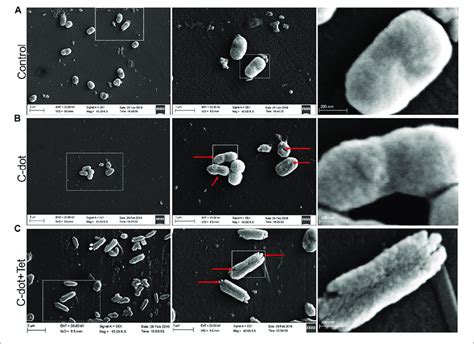 | E. coli cells observed under scanning electron microscopy (40.00 K ...