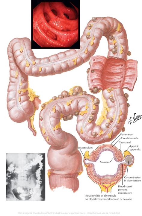 My Good Gut Acquires Puristat.com - My Good Gut | Salute