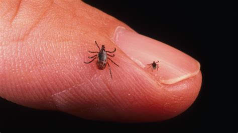 ¡Cuidado con las garrapatas! Se alimentan de sangre y transmiten una peligrosa enfermedad ...