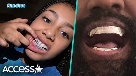 North West Flashes New Grill After Kanye's $850K Titanium Mouthpiece - YouTube